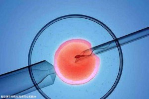 三代试管供卵机构男孩